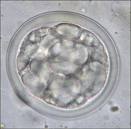 Coccidia