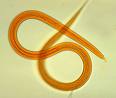 Roundworm