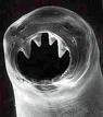 Hookworm